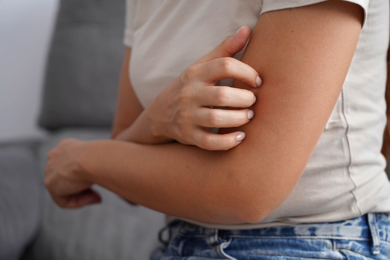 infected bite